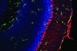 Research in Neuroscience