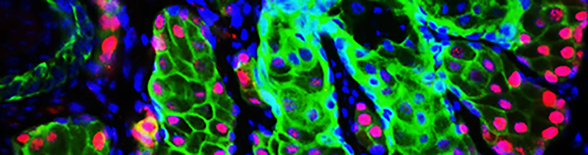 Meibomian gland immunofluorescence image