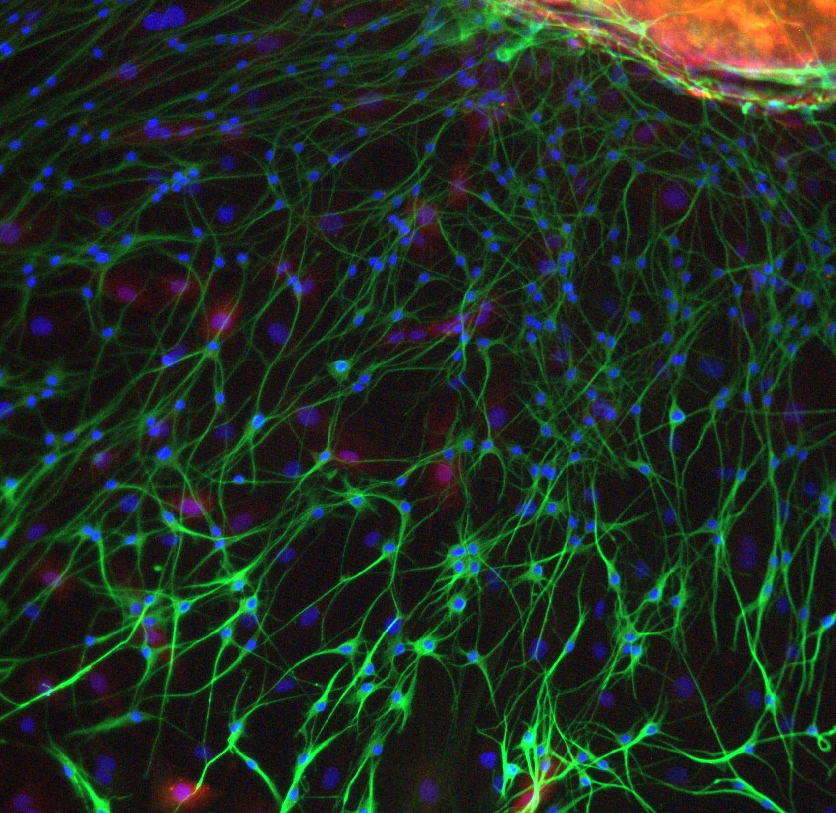Enteric neurons in culture