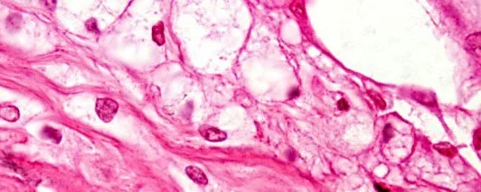 Cells under microscope