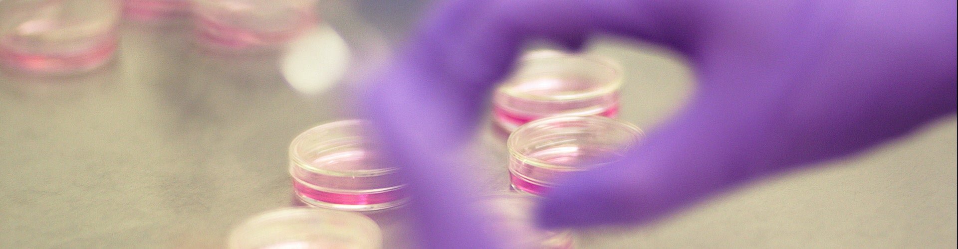 hands with purple gloves holding petri dishes