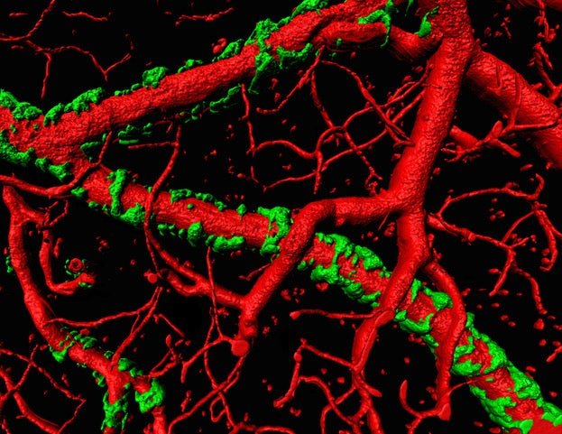 Picture of Amyloid -Sontheimer Lab