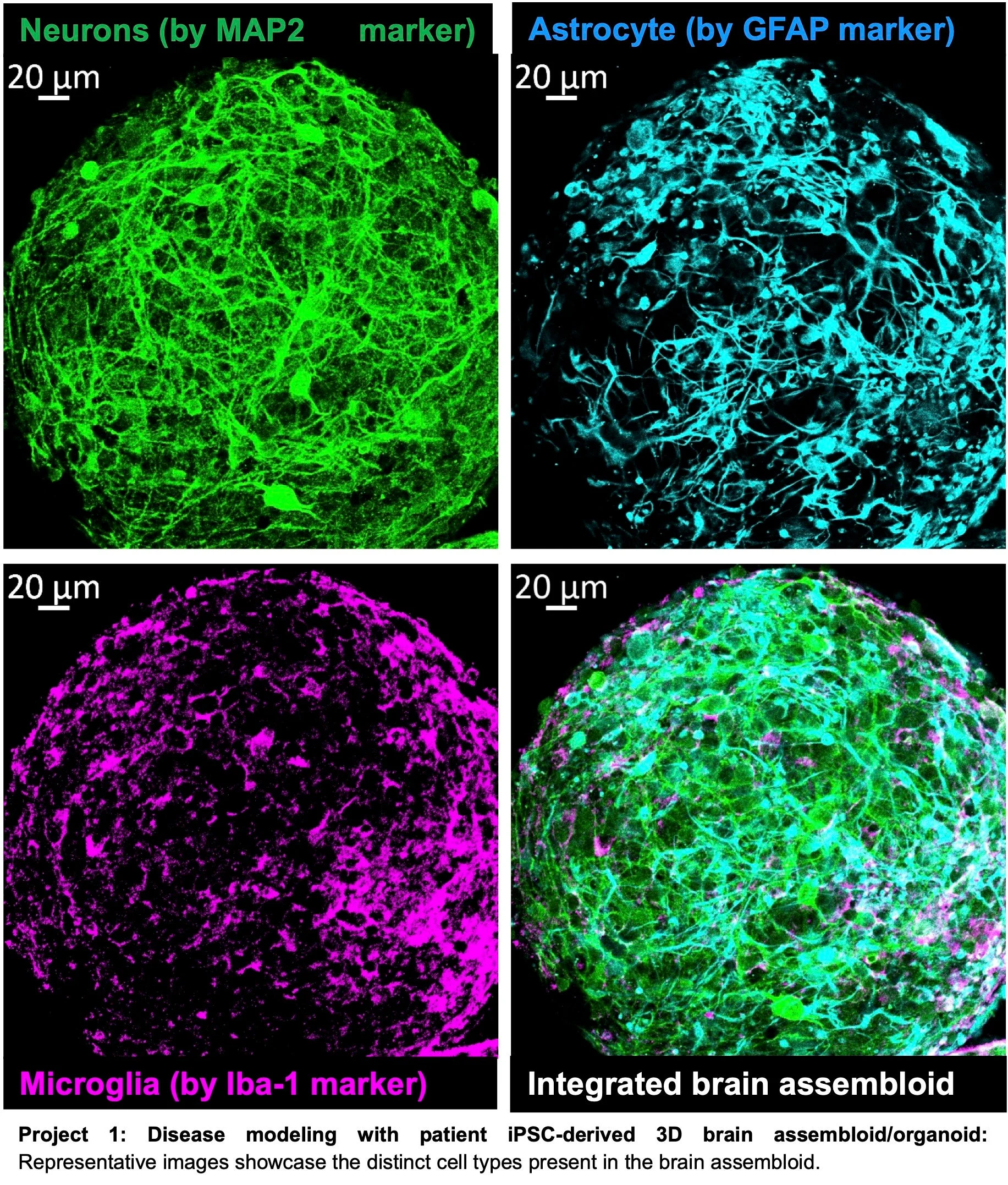 Brain Organoids1 871x1024