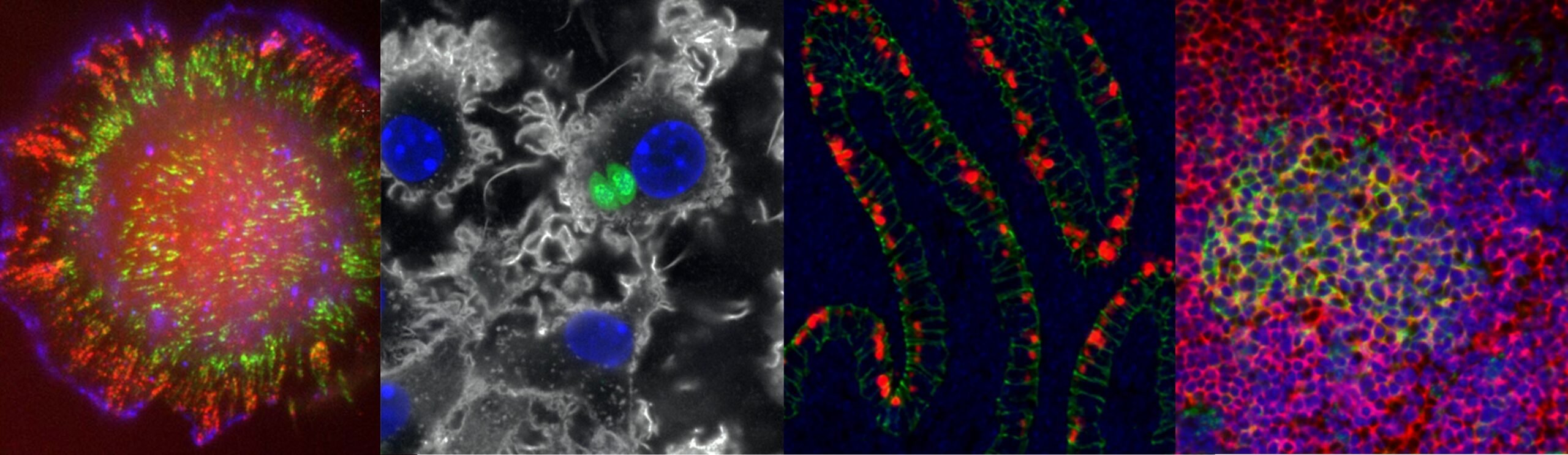 Microbiology, Immunology, and Cancer Biology images