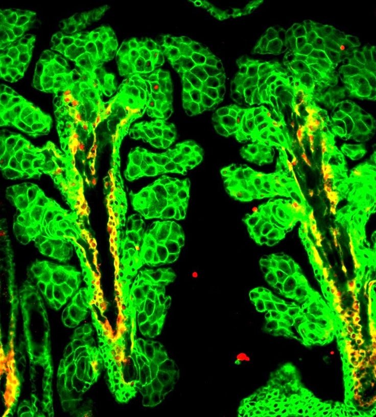 Meibomian glands stained with antibodies against K14 (green) and KROX20 (red)