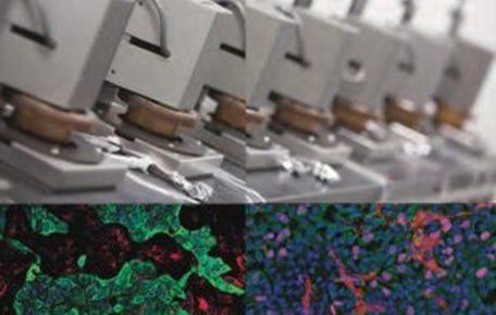 The creation of a 3-D model of a cancer tumor that can replicate the complex nature and behavior of a real tumor.
