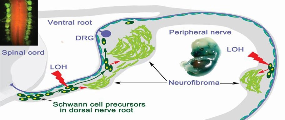 The Le Lab investigates how tumor cells of origin and tumor microenvironment interplay to regulate tumorigenesis. They also study stem cells in tumor, skin, and hair development.
